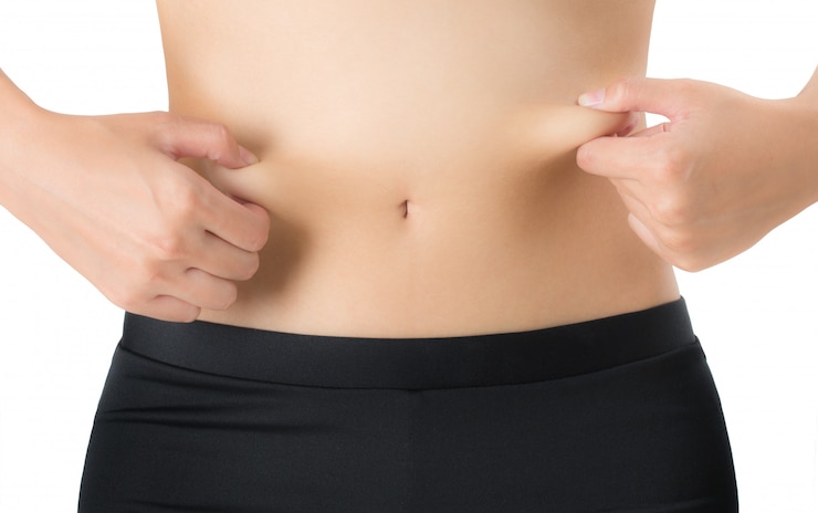 How to Minimize Scarring After a Tummy Tuck?