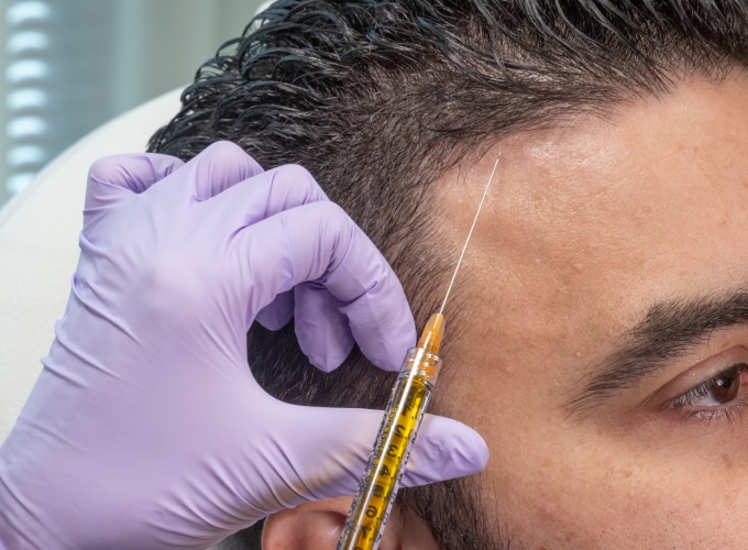 How Does GFC Treatment for Hair Help Strengthen Roots?