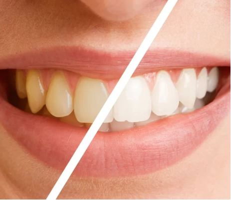 What Makes Cosmetic Dentistry Life-Changing in Newark? 