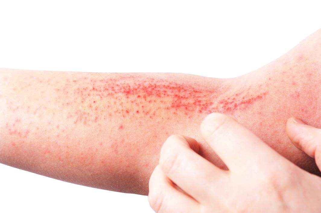 Best Dermatologist For Skin Allergies And Sensitivities?