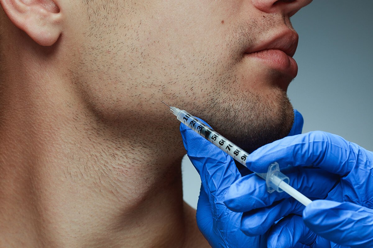 What’s the Ideal Jaw Shape for Fillers Injections?