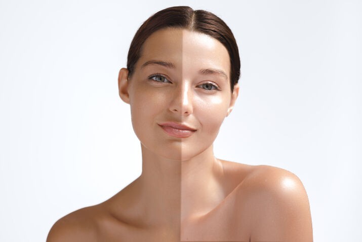 Brighten Face Safely with Skin Whitening