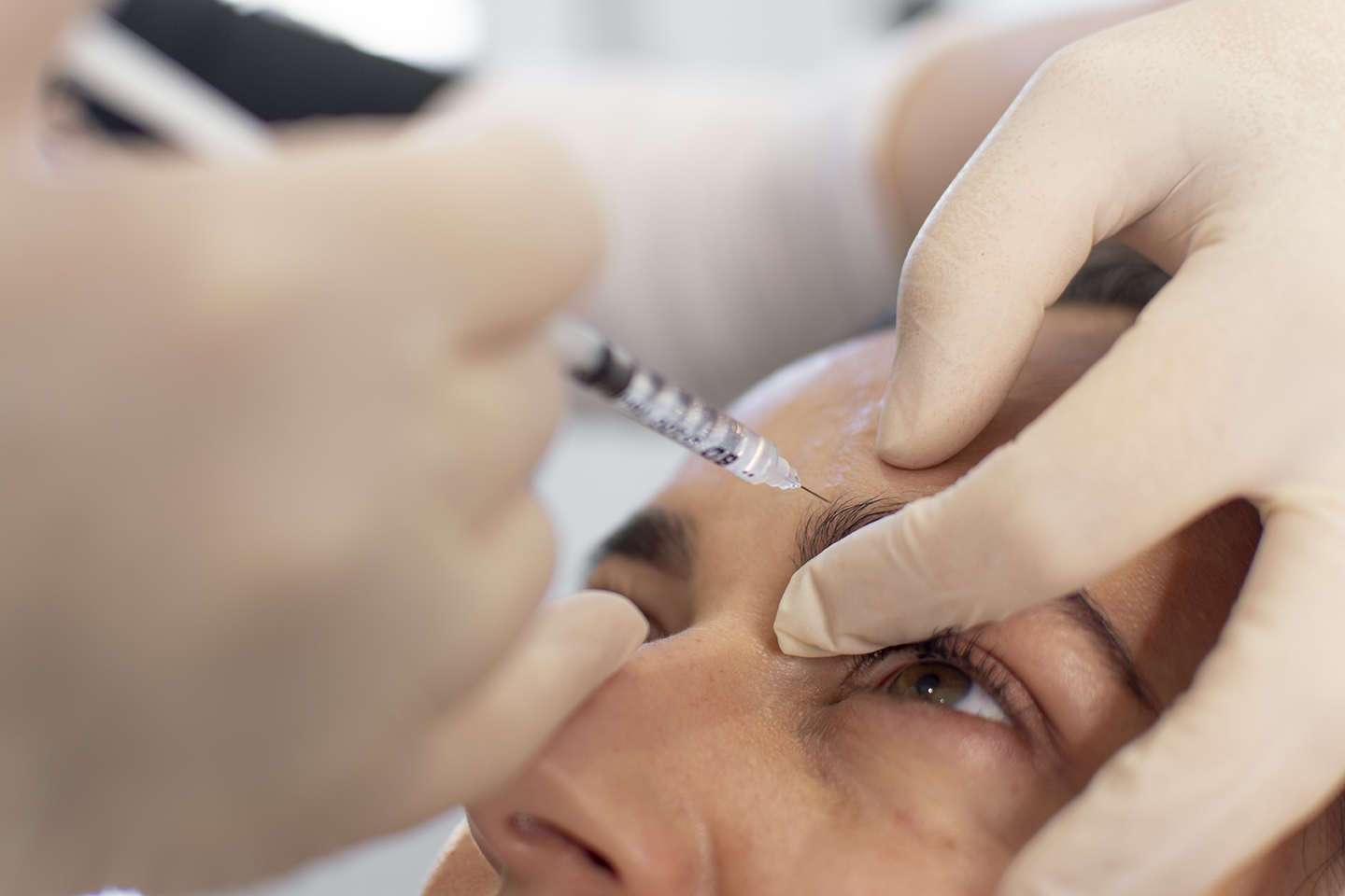 Snatch Wrinkles Away and Reveal Glowing, Smooth Skin Fast with Botox