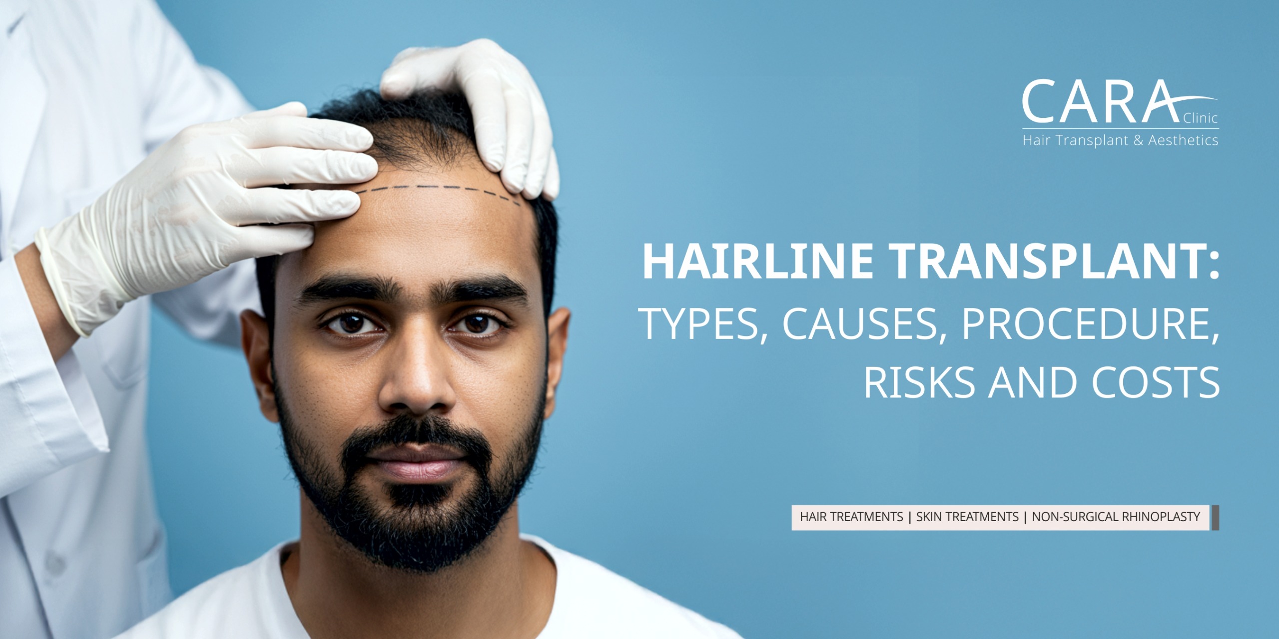 Hairline Transplant: Types, Causes, Procedure, Risks and Costs