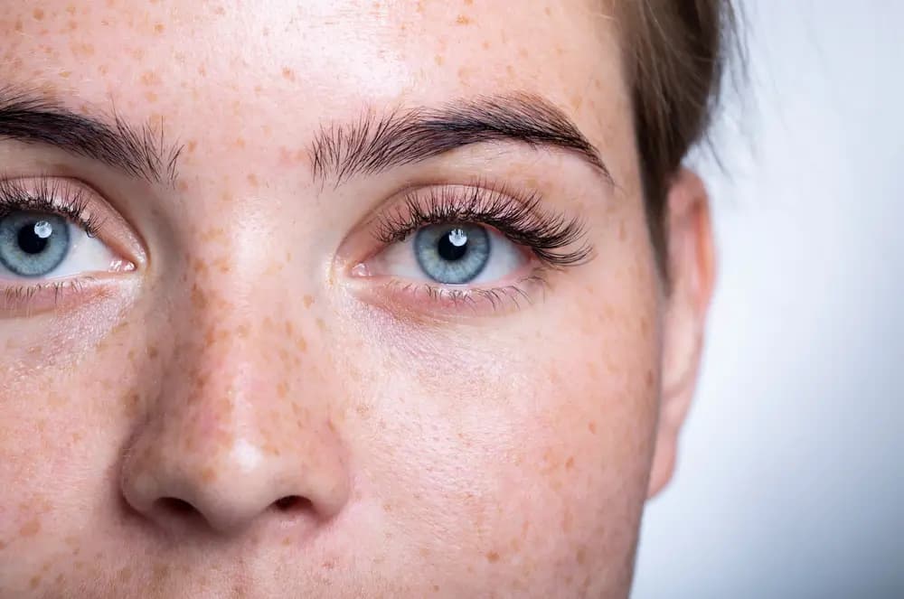 Say Goodbye to Sparse Brows: Eyebrow Transplants in Turkey