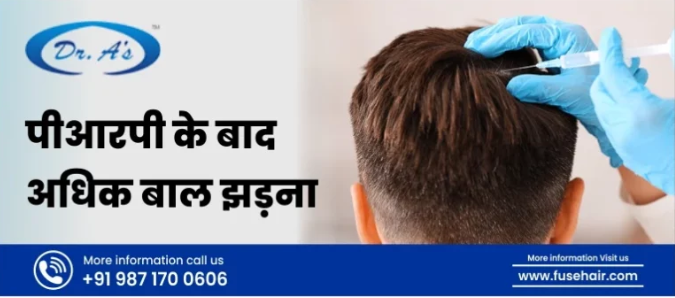 बालों के झड़ने के लिए पीआरपी उपचार | Best Hair Transplant in India