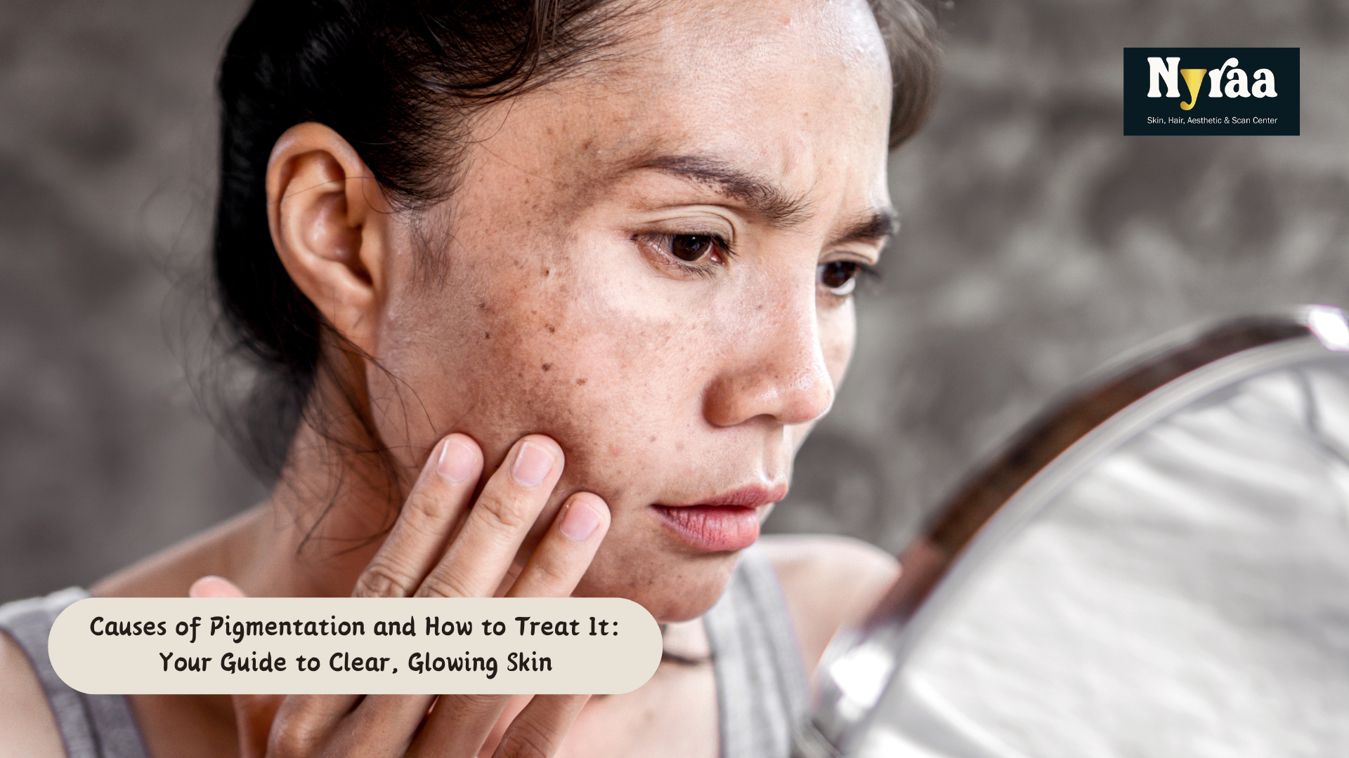 Causes of Pigmentation and How to Treat It: Your Guide to Clear, Glowing Skin
