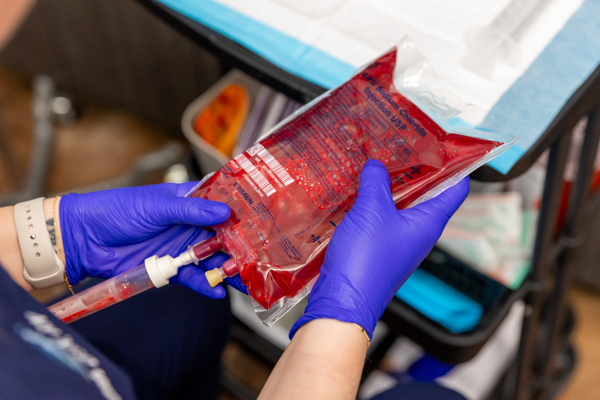 What Are the Hidden Benefits of IV Ozone Therapy?