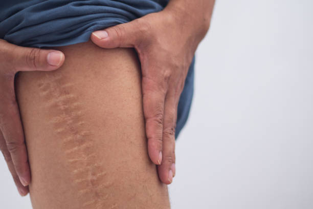 From Surgery to Smooth: Empowering Recovery in Dubai