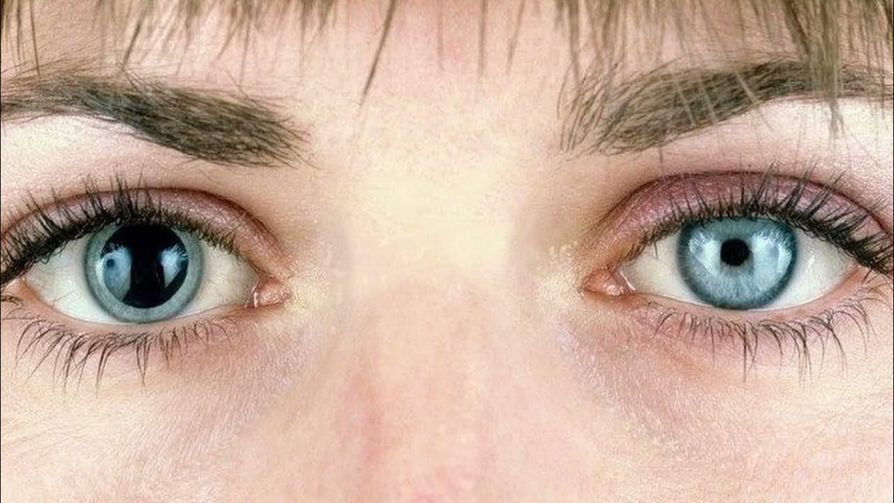 What Causes Small Pupils? Explained Simply