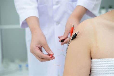 Electroacupuncture, A Modern Twist on Ancient Healing