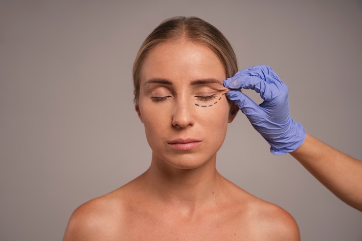 How to Choose a Surgeon for Facelift Surgery?