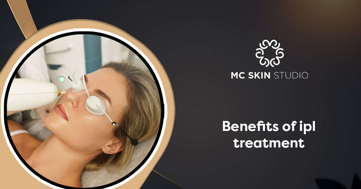 Benefits of IPL Treatment | Your Radiant Skin