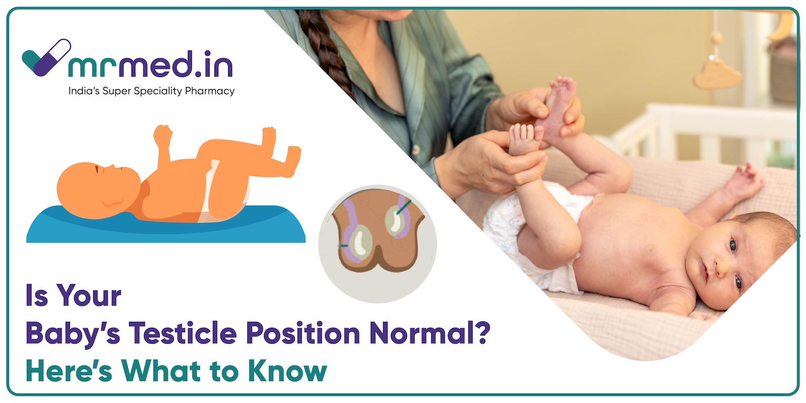 Undescended Testicles in Babies: Should You Worry?