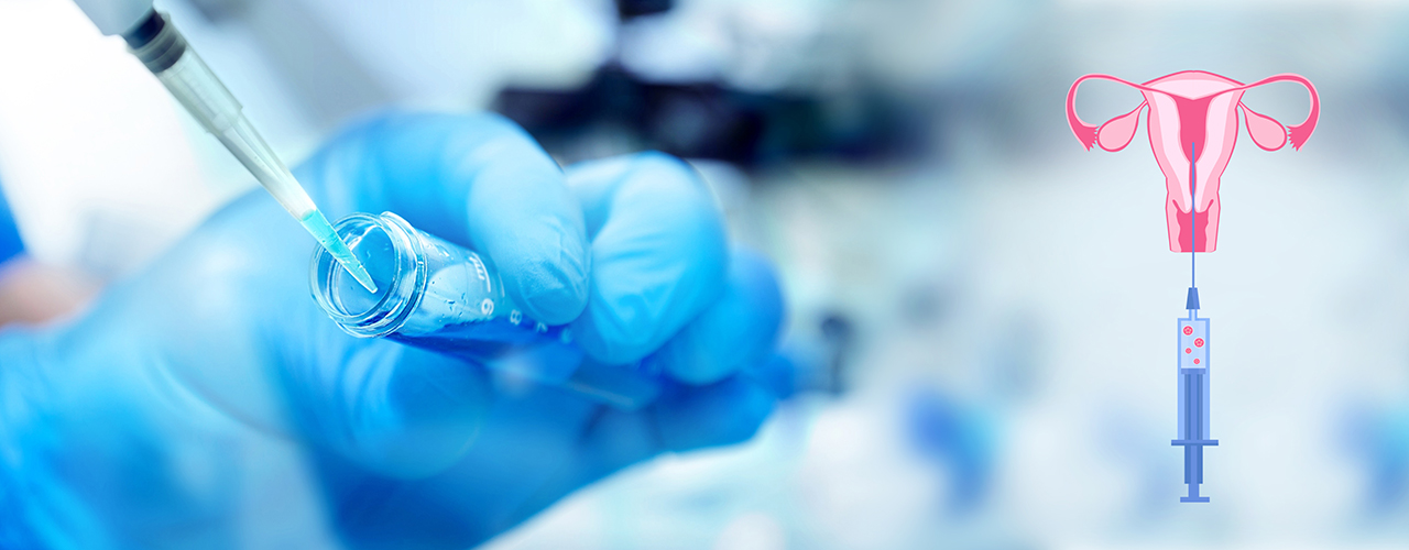 Is Frozen Embryo Transfer Right for You? A Guide for Couples in Bangalore