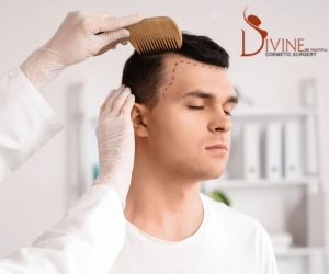 Reclaim Your Confidence with Dr. Amit Gupta – India’s Go-To Hair Transplant & Cosmetic Surgeon