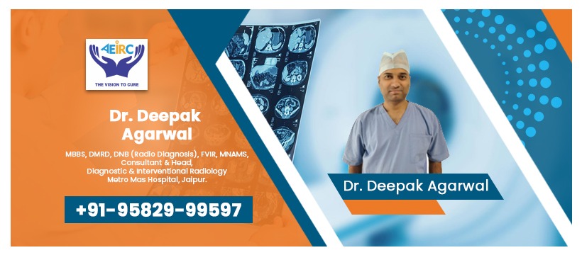 Varicocele Treatment in Jaipur: Comprehensive Care for Your Comfort and Fertility