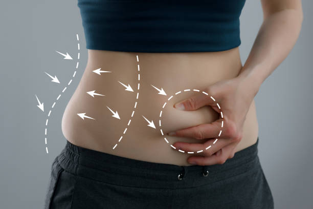 Tummy Tuck Safety in Dubai: What to Know