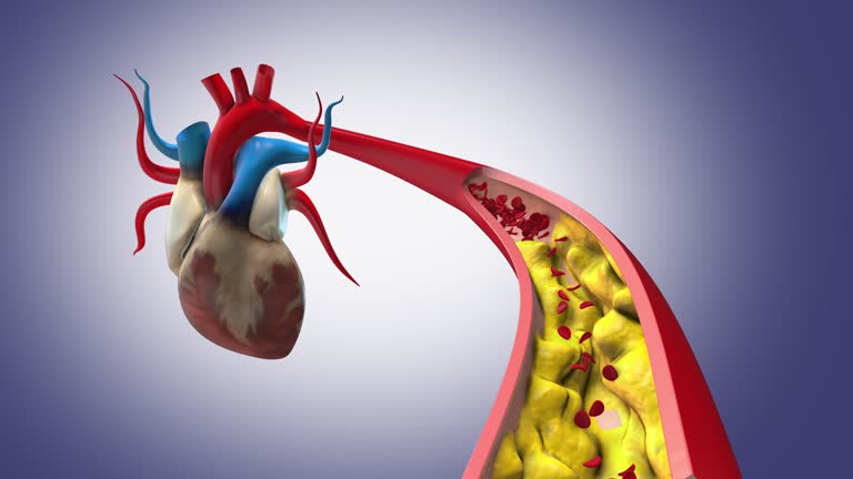 How Angioplasty Can Save Your Heart: Benefits and Recovery Process in Jaipur