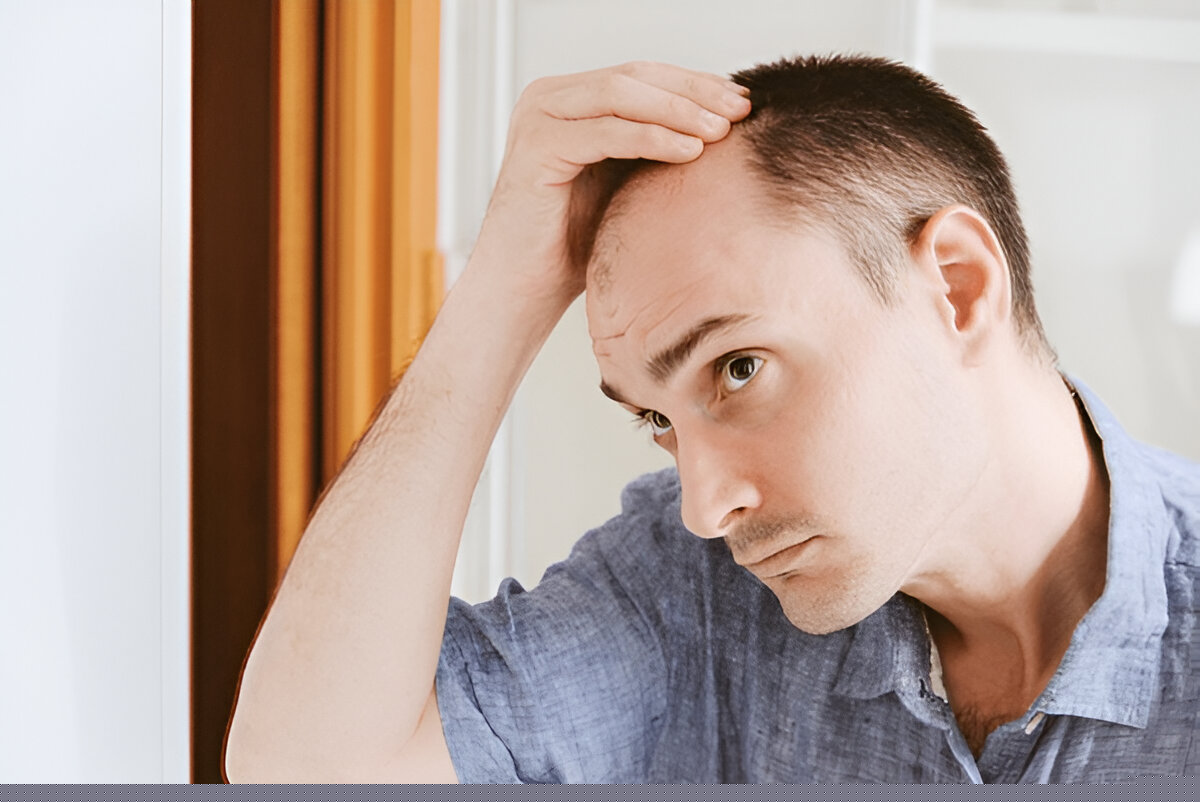 Hair Transplant Recovery Guide in Dubai