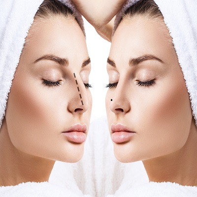 Meet Islamabad’s Leading Rhinoplasty Experts