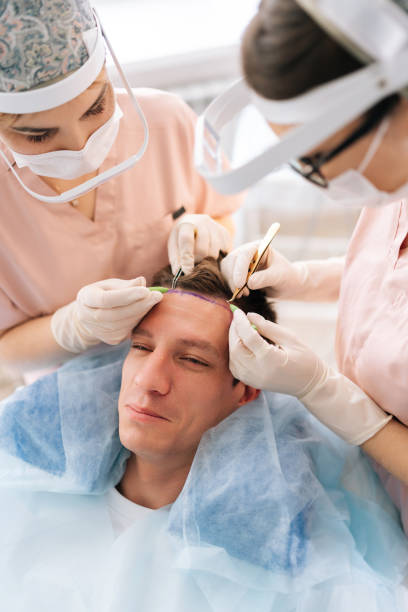 Aftercare Tips for Hair Transplants in Dubai