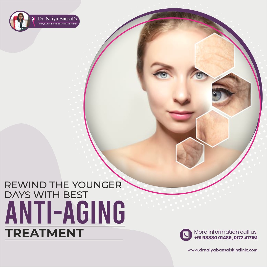 Dr Naiya Bansal - Anti Aging Treatment in Chandigarh