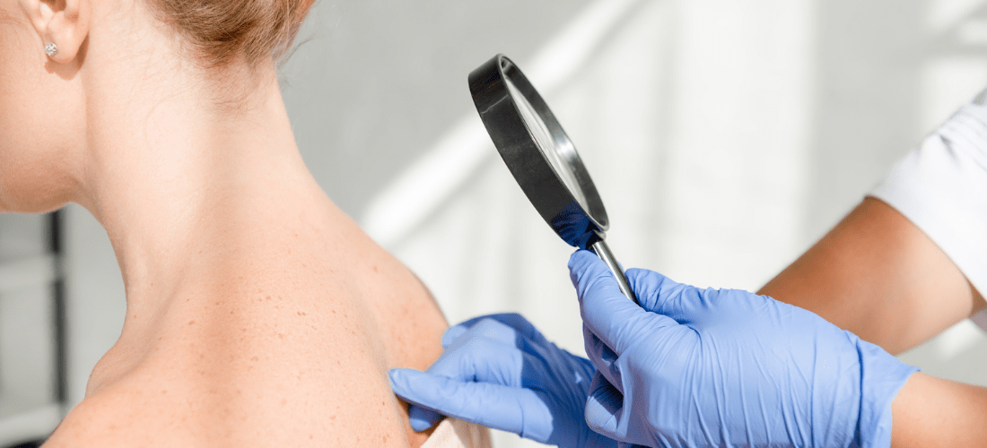 Why Seeing the Best Dermatologist Can Transform Your Skin