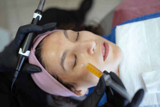 Derma Pen vs. Dermaroller: Which One Is Better?