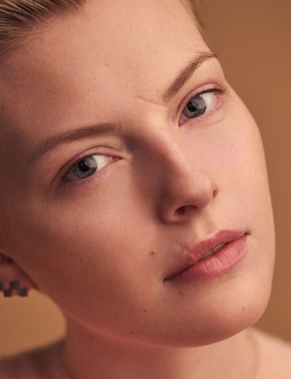 Reclaim Smooth Skin with Facial Scar Revision at Glam Aesthetics Islamabad