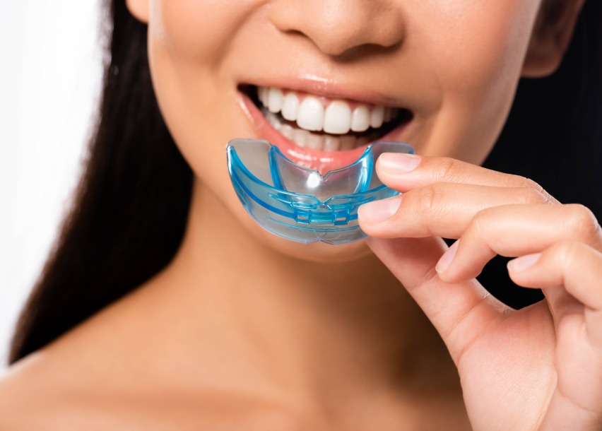 Why You Need a Mouthguard: Protect Your Teeth and Smile