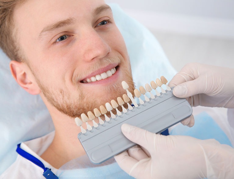 How Long Do Dental Veneers Last? What You Should Expect