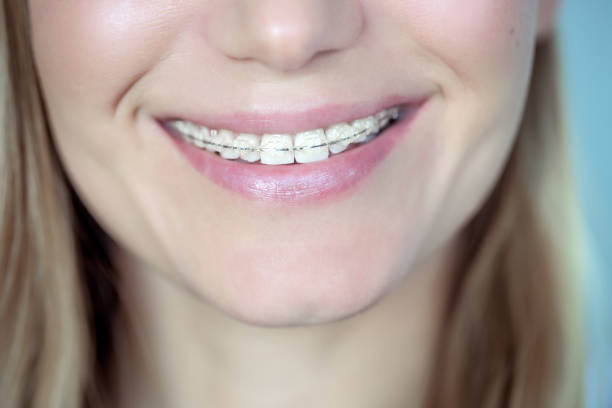 Alles Wat Je Moet Weten Over Tandheelkundige Zorg: Van Kiezen Trekken tot Orthodontie