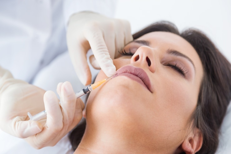 Is Lip Fillers Injections a Quick Procedure?