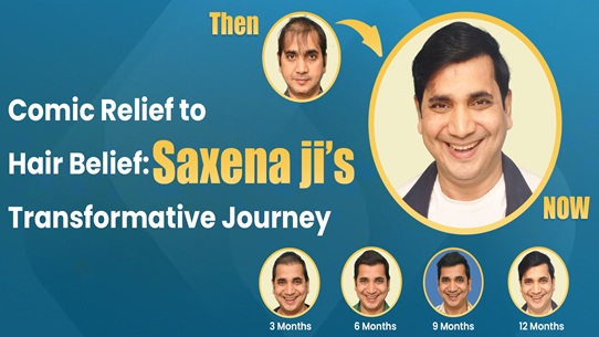 How Much Does a Hair Transplant Cost in Delhi?