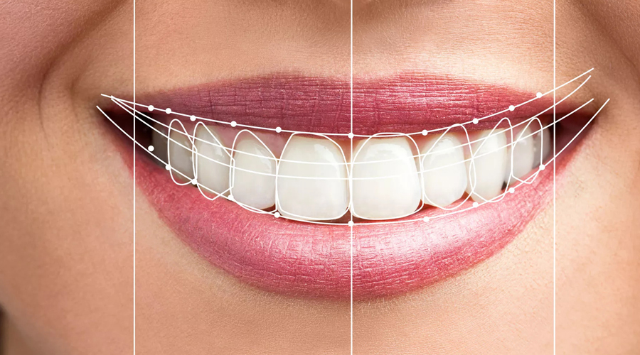 Easy Ways to Make Your Teeth Straightening Comfortable
