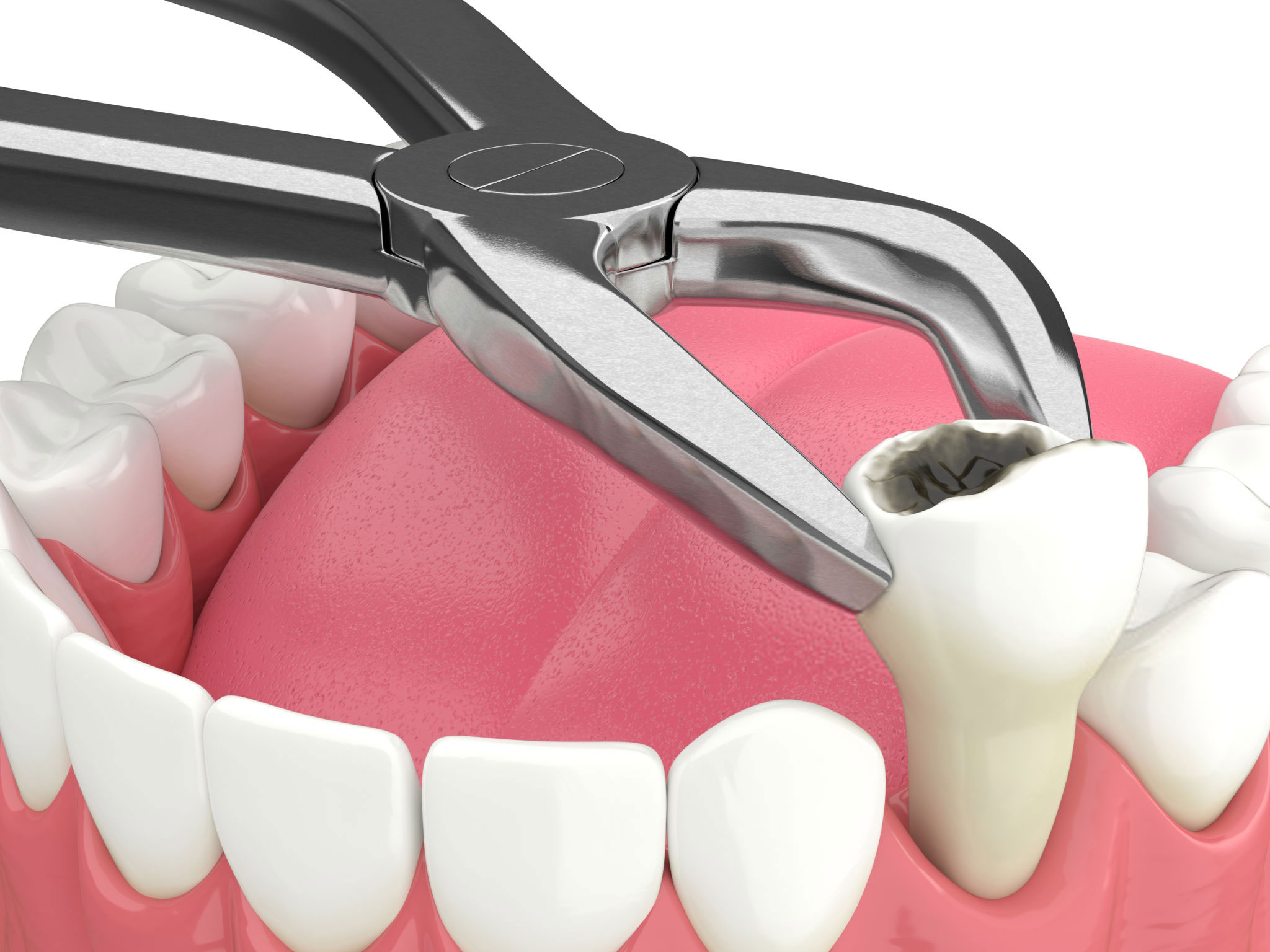 When Is It Necessary to See an Oral Surgeon?
