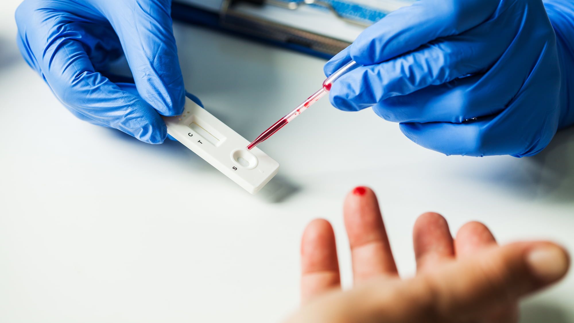 bioMérieux SA: Revolutionizing Norway In-Vitro Diagnostic (IVD) Market through Innovation, Strategy, and Development