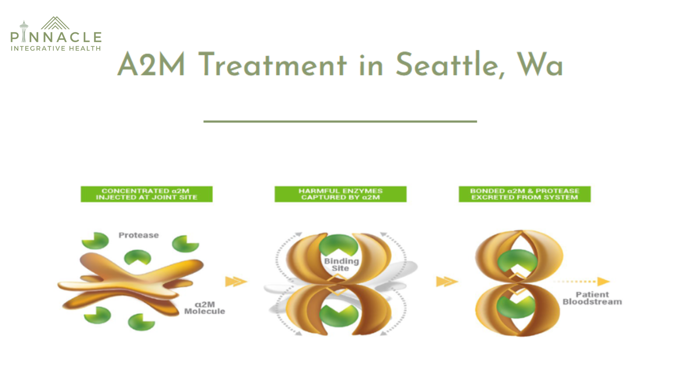 Effective A2M Therapy for Joint Pain Relief Solutions