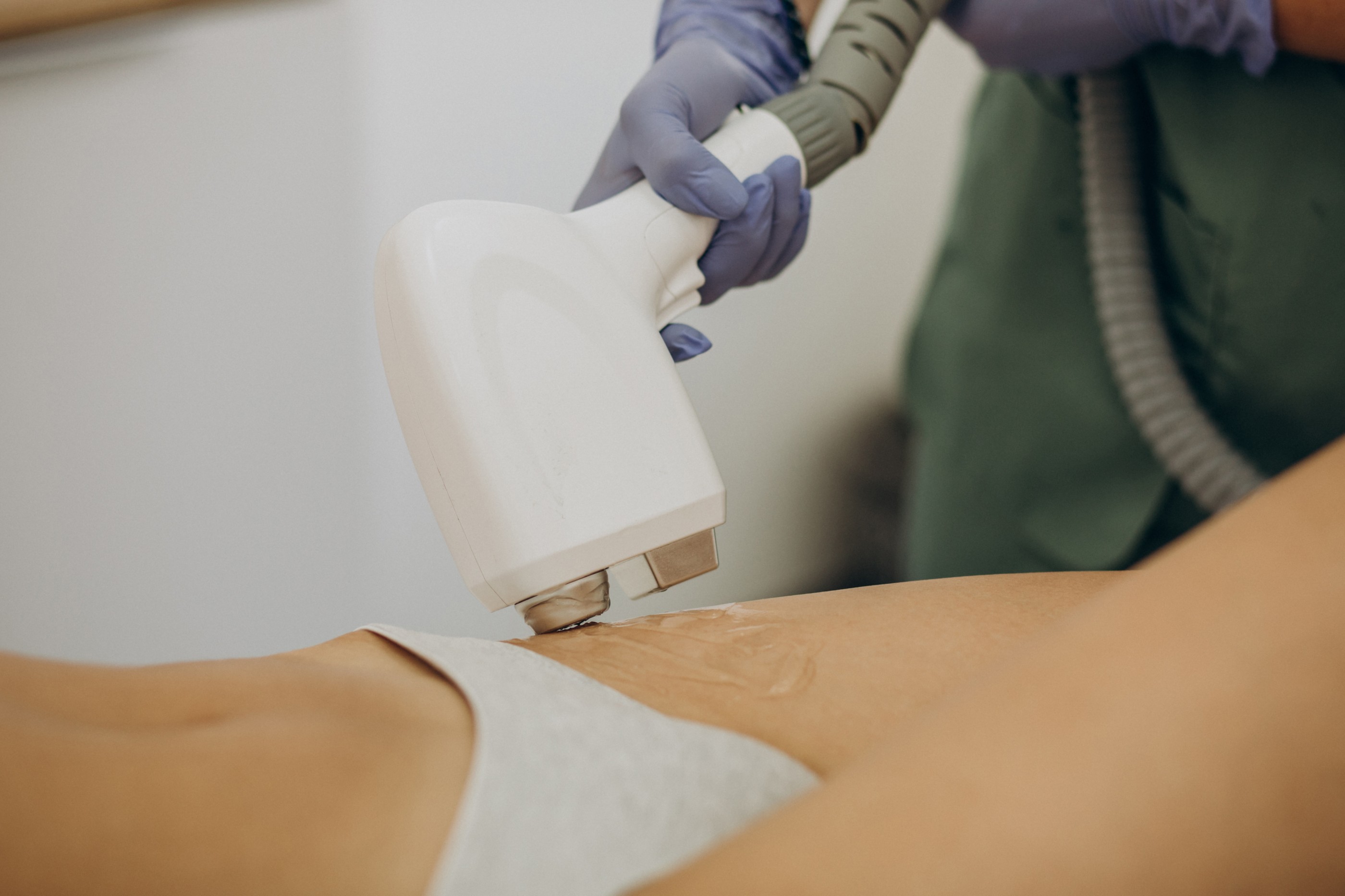 Myth-Busting: Popular Myths Regarding Laser Hair Removal