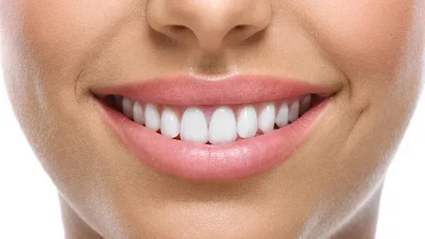Smile Makeovers: The Impact of Smile Improvements on Self-Confidence