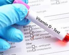 Top Vitamin D Price Test Discounts Near You – Limited-Time Deals 2025