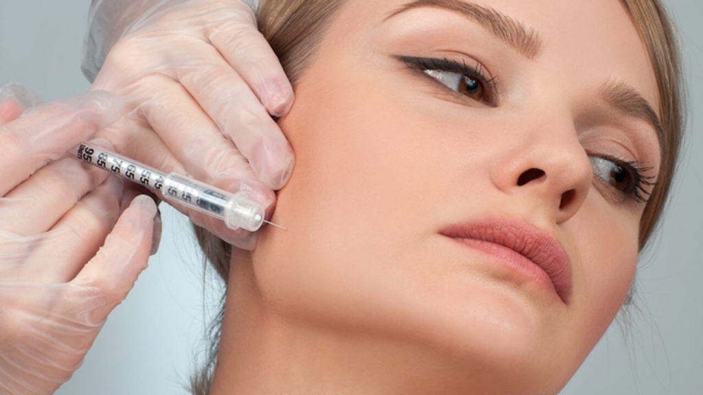 Dermal Fillers for Smile Lines: What You Need to Know