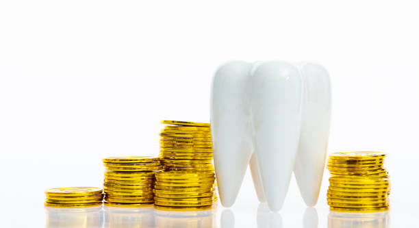 The Benefits of Dental Crowns: Worth the Investment