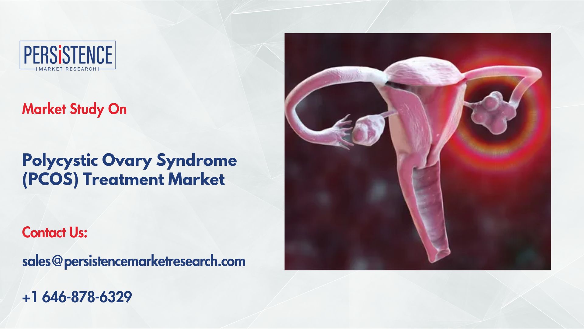 Polycystic Ovary Syndrome Treatment Market Strategies of Key Players
