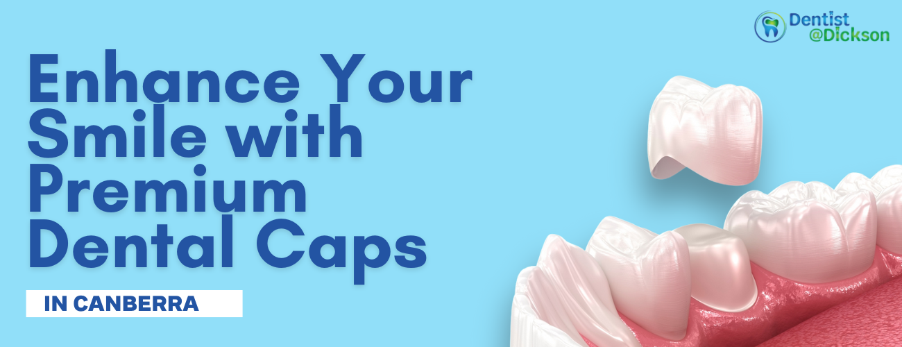 Enhance Your Smile with Premium Dental Caps for Teeth in Canberra