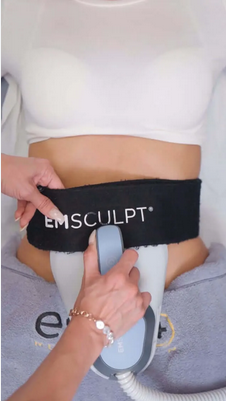 What to Expect During Your First Emsculpt Session in Nottingham