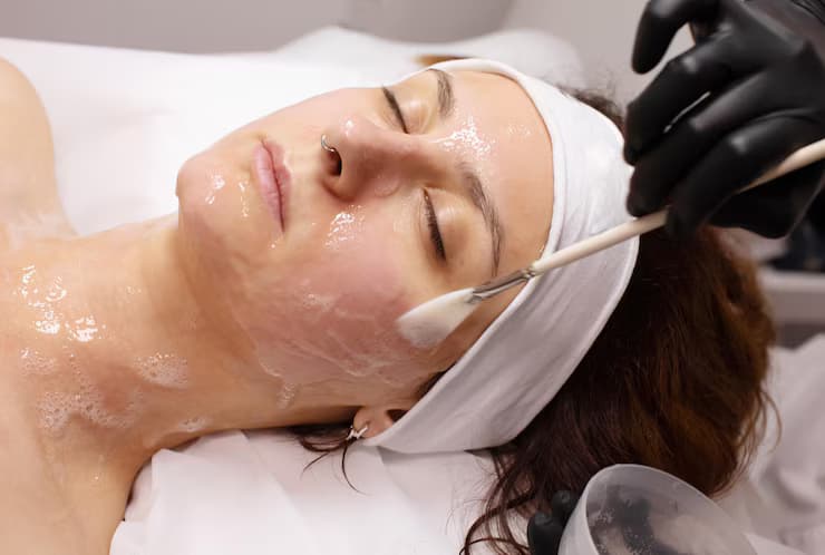 Chemical Peels in Leeds: Which One Is Right for Your Skin?