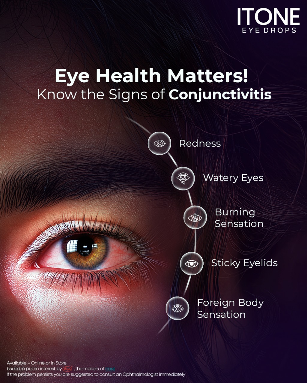 Is Itone Eye Drops Safe for Conjunctivitis Relief?