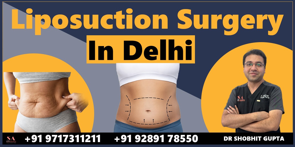 Liposuction Surgery in Delhi: A Complete Guide to Fat Removal and Body Contouring